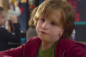 Disfigured Guy Porn - What â€œWonderâ€ Gets Wrong About Disfigurement and Craniofacial Disorder |  Teen Vogue