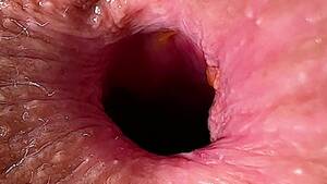 close up ladyboy transexual rectums - Shemale Anal Close Up Videos Porno | Pornhub.com
