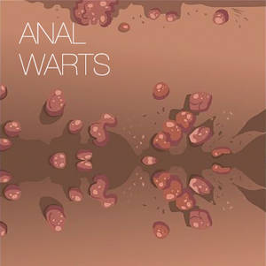 Anal Wart Cream - Anal Warts