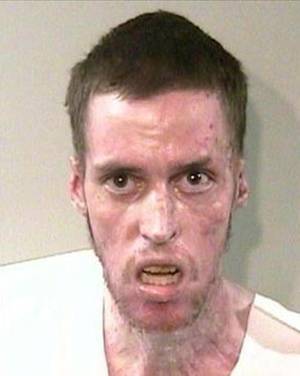 Meth Face Porn - The Shocking Effects of Meth Addiction (45 pics) | Seriously, For Real?