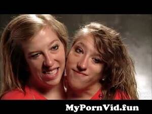 Conjoined Twins Having Sex - Abby and Brittany Hensel: Conjoined Twins - Quick Q&A from conjoined twin  girls nude Watch Video - MyPornVid.fun