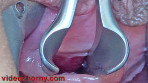 japanese pee hole fucking - Female stretching urethra with speculum Urethral sounding with japanese  probe