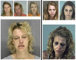 Meth Face - Faces of Meth - Faces of Meth: Striking infographic shows drug's terrifying  toll on human