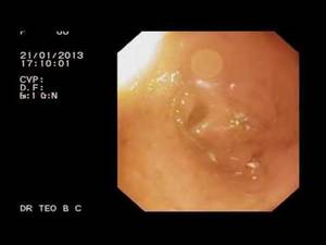 camera is inside ass - 