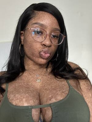 freckled black girl porn - Sexy freckled ebony - Porn Videos & Photos - EroMe