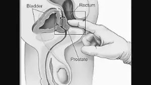 Gay Prostate Porn - Free Gay Prostate Milking Porn Videos | xHamster