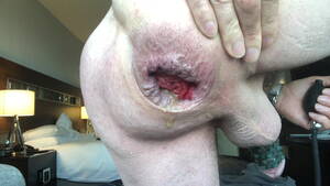 butt plug anal stretching - Anal stretching gaping inflating butt plug | xHamster