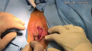 Female Castration Porn - Female circumcision - video 2 - ThisVid.com