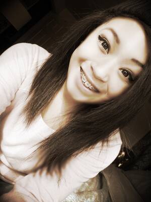 Braces Fetish Porn Tumblr - Braces Fetish Porn Tumblr | Sex Pictures Pass