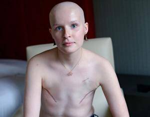 Mastectomy Porn - Search - Mastectomy | MOTHERLESS.COM â„¢