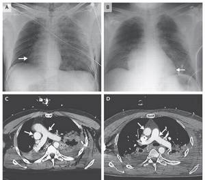 Famous Toon Xray Porn - 
