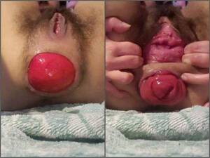 extreme prolapse and anal penetrations - Rare Teen Porn | VixenxMoon Extreme Anal Ruination And Prolapse Play â€“  Premium User Request