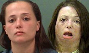 Disfigured Porn - Woman who was left hideously disfigured after explosion at illegal meth lab  is 'caught manufacturing