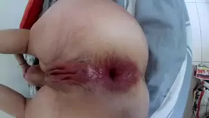 Gaping Anal Sex Porn - C&S GAPING ANAL SEX | xHamster