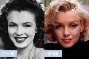 Marie Claire Monroe Porn - The Hairline Electrolysis