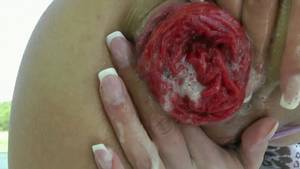 Inside Out Ass Porn - Hotkinkyjo elbow deep going fist deep ass inside-out bum-cork extreme