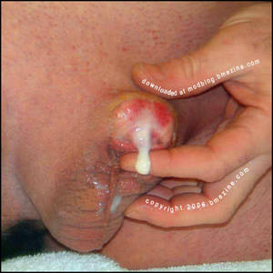 Body Mod Slave Porn - Penectomized Cumshot?