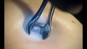 Belly Button - Belly button deep exploration - XVIDEOS.COM