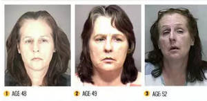 Meth Face - Meth user before