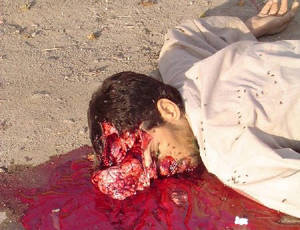 Gross Disgusting Porn - Woops, a tank rolled over this guys head. That is what you are doing to  your brain when you view porn.