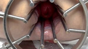 large anal speculum insertion - gs2, BDSM Mistress, massive anal speculum, wide open ass, strapon, extreme  anal gap - XVIDEOS.COM