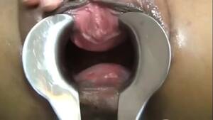 asian speculum porn - Asian speculum - XVIDEOS.COM