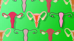 khlo+???+?t? kardashian upskirt - Ovarian Rejuvenation