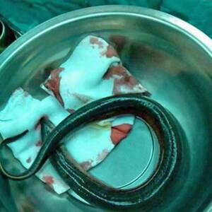 Asian Eel Sex - Porn addict has emergency surgery to remove live EEL he inserted up his  backside to copy x-rated film - Mirror Online