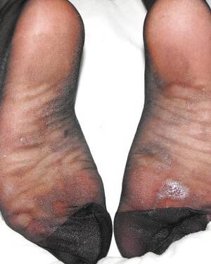 black nylon cum - Cum soaked black nylon soles Porn Pictures, XXX Photos, Sex Images #440396  - PICTOA