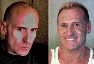 Meth Face - then and now