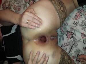 anal gaping milf - Crazy booty russian milf with really giant anus gape â€“ gaping asshole,  colossal dildo download free fisting at our extreme porn hub