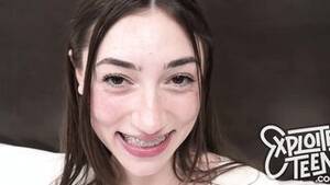 Girls With Braces Porn - Braces Porn | FUQ