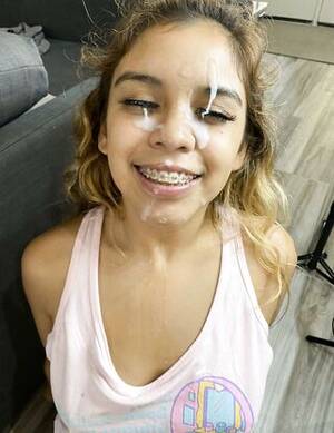 cum face braces - Cute lil' brace face