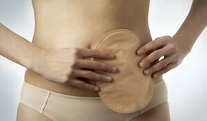 girls forced to have anal sex - Teen Girl Forced To Get Colostomy Bag After Attempting Group Anal Sex - 9GAG