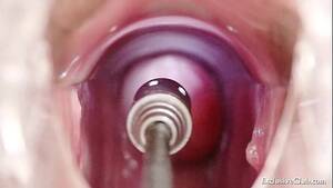 Enema Pussy - Hot blond babe vagina examination and enema - XVIDEOS.COM