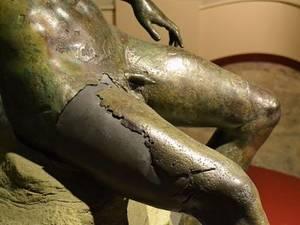 big fat cock priapism - Our Greatest Wealth Is Health