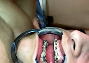 Braces Fetish Porn Tumblr - Braces Gay Porn