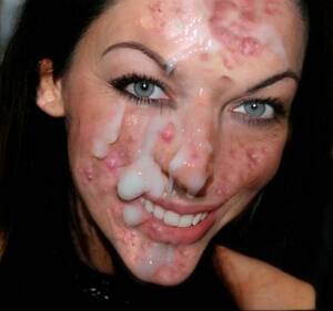 Acne Slut - Acne faced whore sofie loves sperm in ass and face | MOTHERLESS.COM â„¢