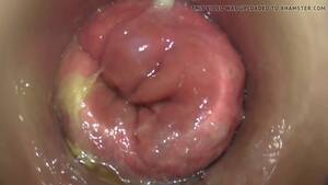 anal camera - ANAL ENDOSCOPY watch online