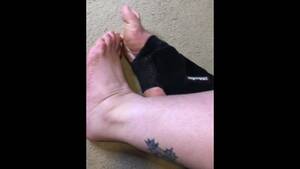 foot heel bruise - New Crutches Sprain Porn Videos from 2024