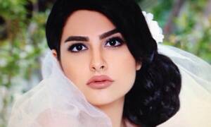 Iranian Face Porn - Modelling Iranian style': surgical alterations and the 'porn star' look |  Iran | The Guardian