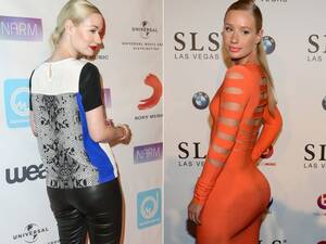 Cartoon Porn Iggy Azalea - Iggy Azalea discusses plastic surgery in Elle Canada interview: 'more  people need to admit that sâ€”' â€“ New York Daily News