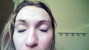 melissa vail cam masturbation - bruised face