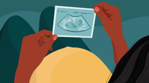 Baby Boy Girl Sex - Nub Theory: Does 'Angle of the Dangle' Predict Baby's Sex?