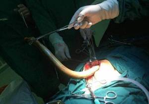 Eel Porn - This was reportedly the eel which was removed from the vlogger through an  incision in her