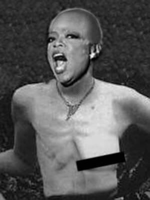 Cancer Porn - Cancer porn - Uncyclopedia