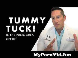 fat upper pelvic area - Is The Pubic Area Lifted in a Tummy tuck? from fat mons Watch Video -  MyPornVid.fun