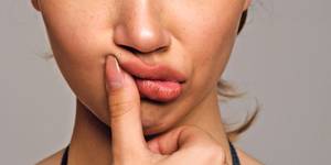 Nose Bump Porn - Stocksy