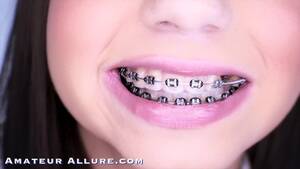 Braces Hd Tiny Porn - Tiny Stepdaughter Stepsister Schoolgirl W/ Braces Sucks Cock & Gets Fucked  - Pornhub.com