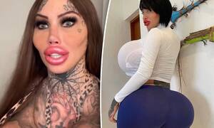 Butt Injections Porn Stars - Surgery-addicted social media star sparks health fears with latest butt  injections | Daily Mail Online